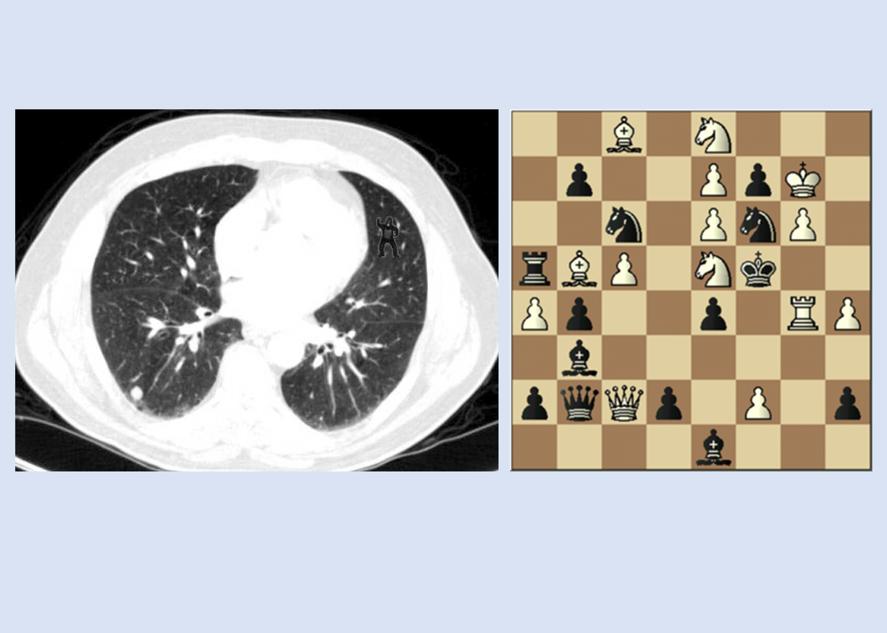 Gorilla CT and Chess Board